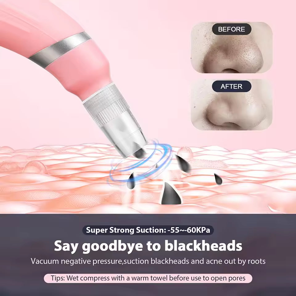 جهاز تنظيف المسام الماسي الدقيق يزيل الجلد الميت مع جهاز تجميل تجديد البشرة الميكروكريستالين عالي الشفط