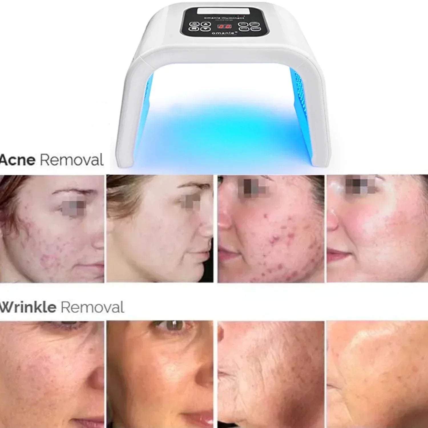 7-Color LED Photon Heating Facial Mask for Home Skin Care-2